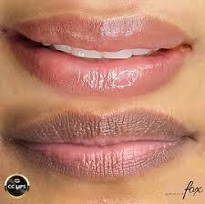 Referencia visual de labios antes y después de neutralización